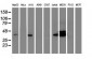 BCAT1 / ECA39 Antibody (clone 3F5)
