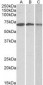 OAS2 Antibody (aa357-371)