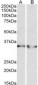 LDHB / Lactate Dehydrogenase B Antibody (aa15-25)