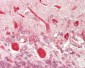 HTR2C / 5-HT2C Receptor Antibody (aa400-450)