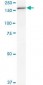 MPO / Myeloperoxidase Antibody (clone 3E11)