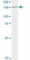 MPO / Myeloperoxidase Antibody (clone 3E11)