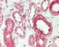 SYK Antibody (aa5-360)