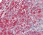 SYK Antibody (aa5-360)