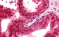 HDGF Antibody