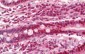 HDGF Antibody