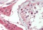 PLAT / TPA Antibody