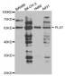 PLAT / TPA Antibody