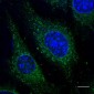 RAB5A / RAB5 Antibody (C-Terminus)