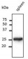 RAB5A / RAB5 Antibody (C-Terminus)