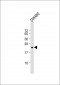 TIMP2 Antibody