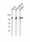 CD130 Antibody (C-term)