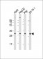 PDCD1LG2 Antibody (N-term)