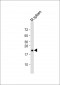 Bax Antibody (BH3 Domain Specific)