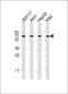 F9 Antibody (Center)