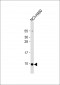 CCL17 Antibody(C-term)