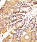 (Mouse) Epcam Antibody (C-term)