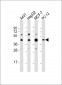 MAPK3 Antibody (N-term)