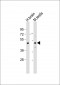 TGFB3 Antibody (Center)