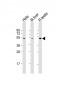 CHRNB2 Antibody (N-Term)