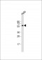 CYP2E1 Antibody (Center)