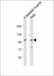 ATXN2 Antibody (Center)