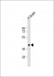 ARRB2 Antibody (C-Term)