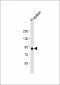 VAC14 Antibody (N-Term)