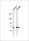 GLS Antibody (N-Term)