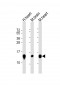 NDUFB3 Antibody (N-Term)