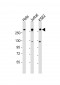 CHD3 Antibody (N-Term)