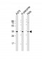 FGF5 Antibody (N-Term)