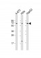 CHRNA4 Antibody (C-Term)