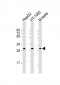 ZMAT3 Antibody (Center)