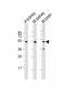 NDUFV1 Antibody (N-term)