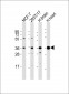 BRCC3 Antibody (N-Term)