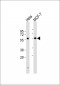 Dyskerin Antibody