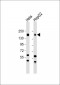 EGFR (pS1026) Antibody