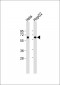 FUBP3 Antibody