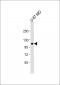 CD61 Antibody