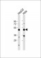 RSAD1 Antibody