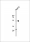 ZFP36L2 Antibody