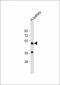 DDC Antibody (N-term)