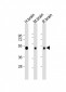 NPTX1-Y344 Antibody
