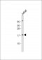 RBM3 Antibody (Center)