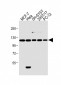 Insulin Receptor R Antibody (N-term)