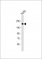 PREX1 Antibody (Center)