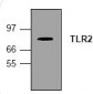 TLR2 Antibody (Clone BV31-9)