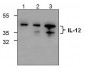 IL-12p40 Antibody