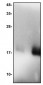 IL-1RA Antibody